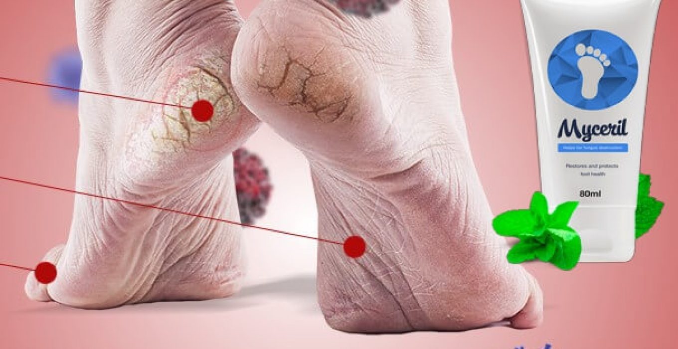 myceril crema, infezione fungina funghi