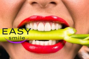 Easy Smile Veneers: ritrova un sorriso perfetto in un click?
