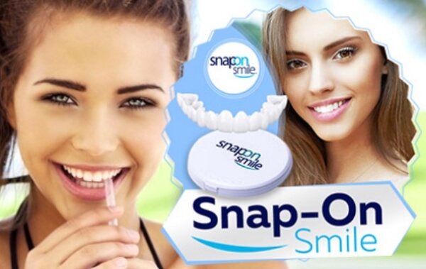 Snap-On Smile recensioni e opinioni dai forum online Italia