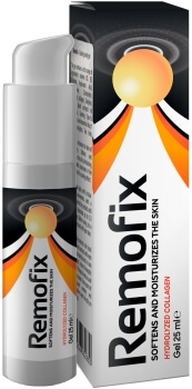 Remofix gel Recensioni Italia