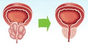 Ingredienti ed effetti di VitaMan Plus Ingredienti ed effetti di VitaMan Plus